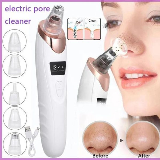 Face Vacuum Suction Blackhead Remover Pore Cleaner (Rechargeable)